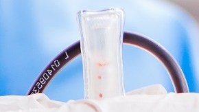 Hombre hospitalizado