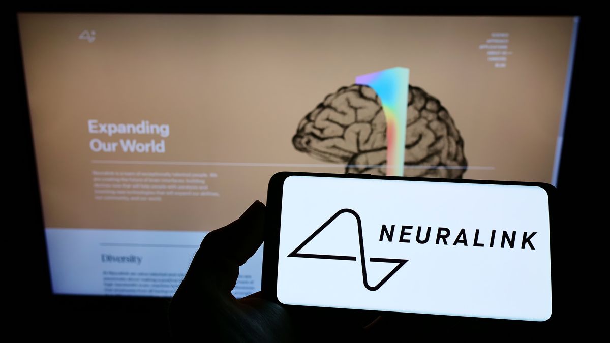 El proyecto de insertar un chip en el cerebro avanza rápidamente y Neuralink podría insertarlo en un humano el próximo año.