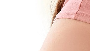 sobrepeso y obesidad