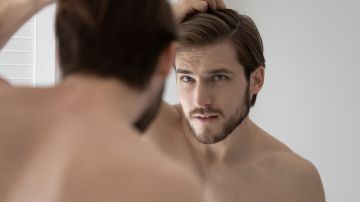 Caída del cabello en hombres