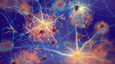 Neuronas