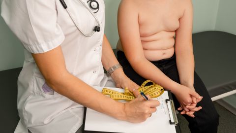 Obesidad infantil