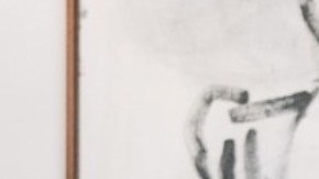 Álvaro Pérez Miranda.