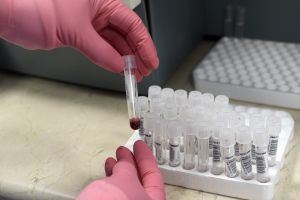 Otra persona se declara libre de VIH tras un trasplante de células madre sanguíneas, según médicos alemanes