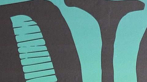 Lily Allen y David Harbour contrataron a especialistas para la remodelación.