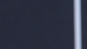 Chiky Bombom habló con claridad sobre la cirugía a la que se sometió para ayudarse a bajar de peso.