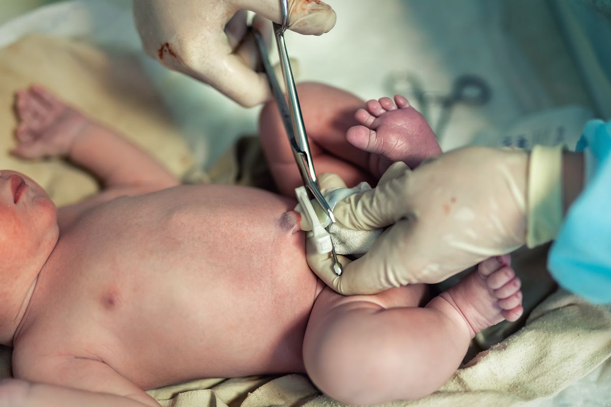Los bebés con macrosomía nacen por cesárea