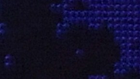 Rick Allen, baterista de Def Leppard