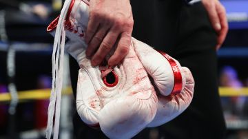 Boxeador ucraniano muere en combate. Imagen referencial.