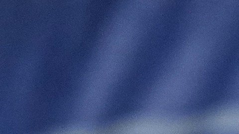 Karim Benzema es atendido de su lesión en la tibia.