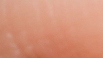 gotas-para-ojos-retiro