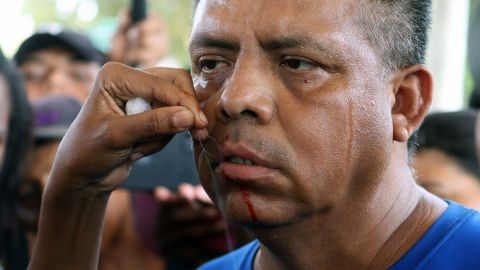 Un migrante se cose la boca durante una protesta en Chiapas.