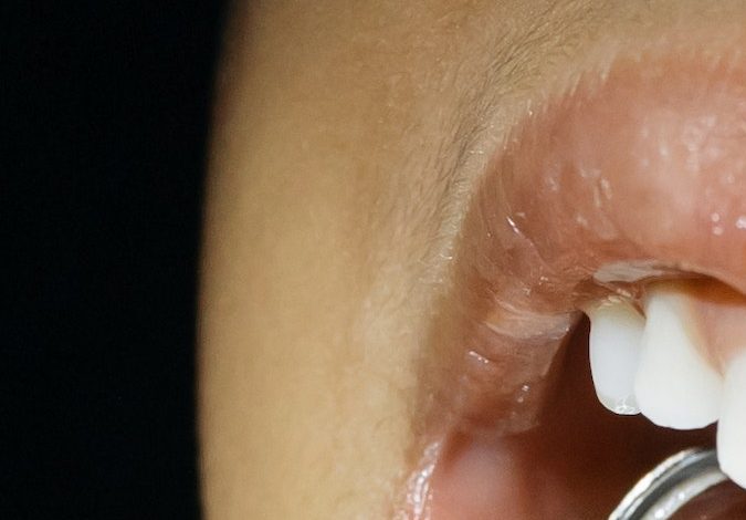 Dientes niño