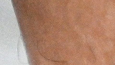 Las heridas en células cutáneas cultivadas cicatrizan tres veces más rápido cuando se estimulan con corriente eléctrica.