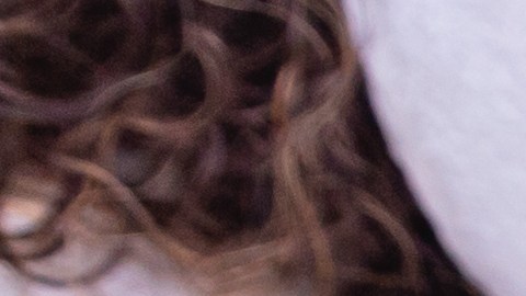 Cropped,Shot,Of,A,Professional,Dermatologist,Performing,Radiofrequency,Lifting,Procedure