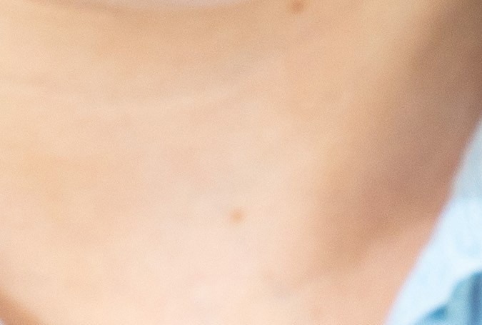 Persona sosteniendo un frasco de omeprazol y pastillas en la mano para tratar la acidez