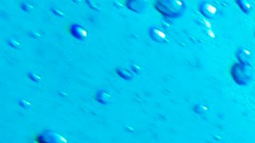 El tiburón atacó al hombre mientras pescaba.