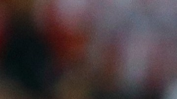 La víctima tuvo que retirarse antes que iniciara el partido entre Tigres y Chivas.