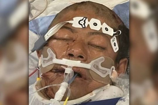 Ciclista hispano fue gravemente herido en accidente de tránsito en Brooklyn, está en estado crítico y sin identificar
