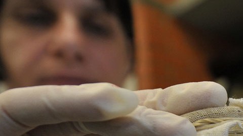 Las picaduras de estos diminutos arácnidos pueden afectar la piel, al sistema nervioso, corazón, articulaciones y músculos