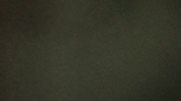 El jugador ha venido presentando fuertes dolores en la rodilla derecha por una artrosis.