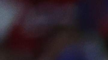 El lanzador tuvo que pasar por cirugía tras lesionarse en el Clásico Mundial de Beisbol.