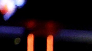 La estrella de los Knicks podría estar fuera durante el training camp.