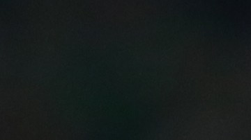 El delantero fue operado y pasará varias semanas en rehabilitación.