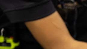 En caso de no haber recibido atención médica la pequeña pudo haber muerto