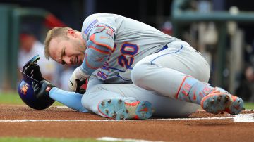 Problemas para los New York Mets: Pete Alonso ingresará en la lista de lesionados tras recibir pelotazo a 97 MPH