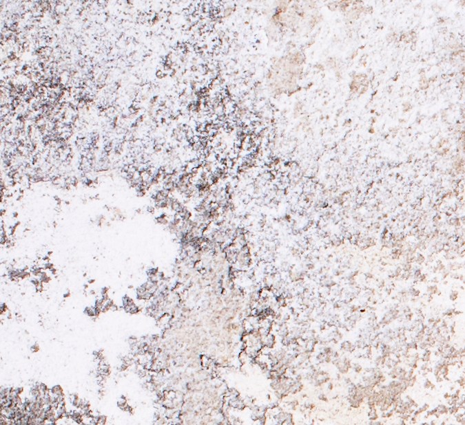 Alimentos ricos en zinc