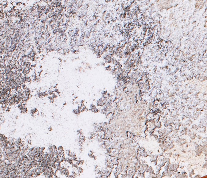 Alimentos con selenio