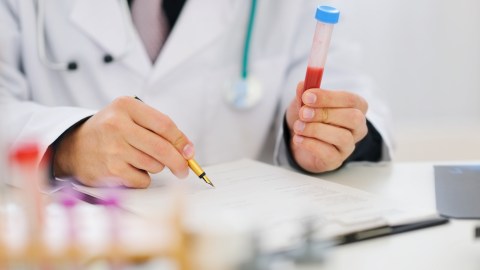 Examen de sangre