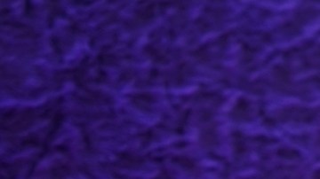 La venezolana Migbelis Castellanos asistió a uno de los estudios de Univision.