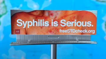 Sífilis en California