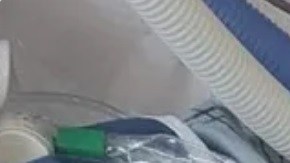 Desde que García recuperó la conciencia, los familiares han trabajado todos los días para levantarle el ánimo.