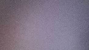 Saquon Barkley de los New York Giants y otros jugadores se ven afectados por la crisis en el mercado de corredores de la NFL