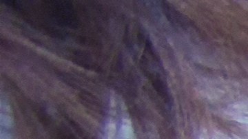 Trasplante de órganos