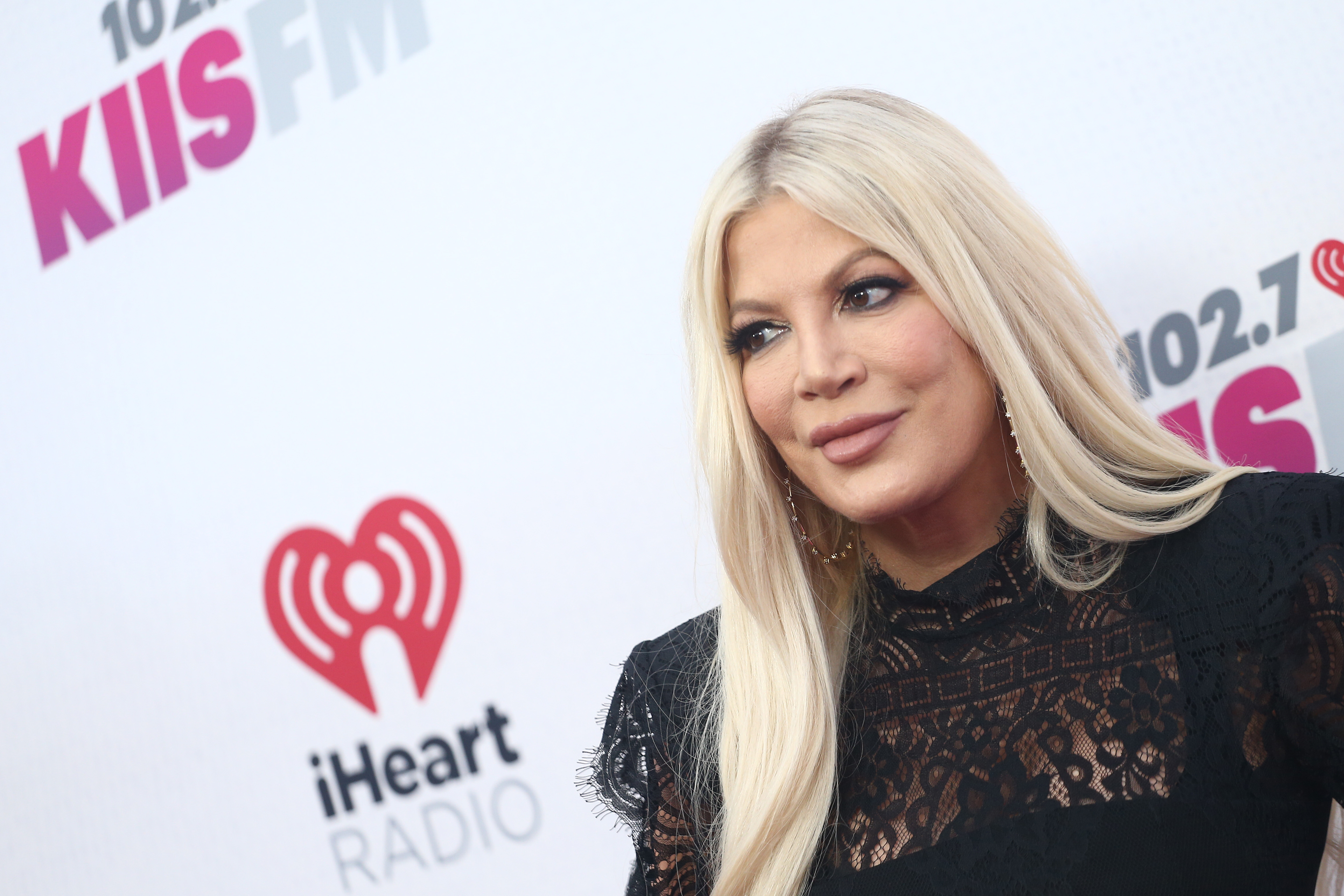 Tori Spelling Fue Vista Con Moretones En El Rostro A Su Salida Del ...