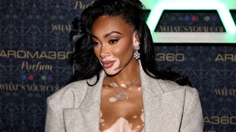 Winnie Harlow es la primera modelo con vitilígo en obtener fama mundial.