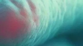 La vibrio vulnificus afecta especialmente a ancianos o personas mayores con problemas en su sistema inmunológico y solo se combate con antibióticos.