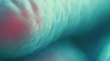 La vibrio vulnificus afecta especialmente a ancianos o personas mayores con problemas en su sistema inmunológico y solo se combate con antibióticos.