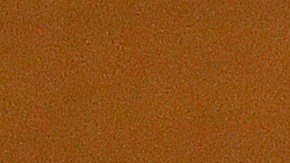 Una lesión obligará a Stephen Strasburg de los Washington Nationals, a retirarse de la MLB de forma prematura