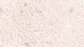 Por sus componentes naturales, el vinagre representa una opción para desinfectar sin el uso de químicos