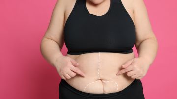 Obese,Woman,With,Marks,On,Body,Against,Pink,Background,,Closeup.