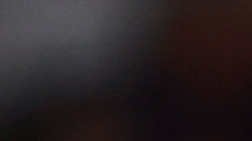 Luis Severino al momento de lesionarse frente a Brewers.