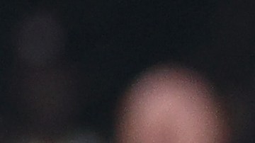 Aaron Rodgers al momento donde su tobillo queda enganchado de la grama artificial.