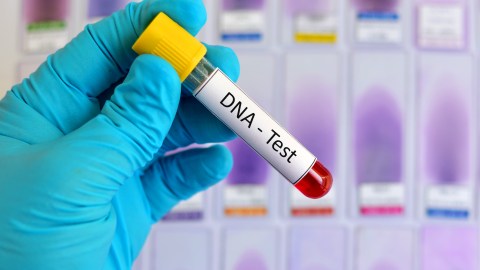 Prueba de ADN