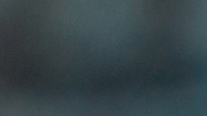 Operation,Using,Laparoscopic,Equipment