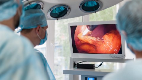 Operation,Using,Laparoscopic,Equipment